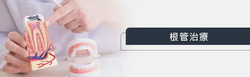 根管治療 根管治療